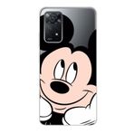 Manitoba Xiaomi Redmi Note 11 Pro/Note 12 Pro 4G ile Uyumlu Mickey Tasarımlı Baskılı Şeffaf Telefon Kılıfı