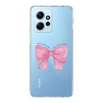 Manitoba Xiaomi Redmi Note 12 4G ile Uyumlu Fiyonk Tasarımlı Baskılı Şeffaf Telefon Kılıfı