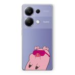 Manitoba Xiaomi Redmi Note 13 Pro 4G ile Uyumlu Sevimli Domuz Tasarımlı Baskılı Şeffaf Telefon Kılıfı