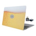 McStorey MacBook Air M1 Kılıfı 13 İnç A2337 A2179 A1932 Uyumlu Sert Kapak Hard Case Koruyucu Kılıf Köpük Efektli UV Baskılı Özel Tasarım Çizilme Önleyici İnce Hafif Sarı