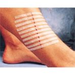 Medikal 3m Steri-Strip Dikiş Bantları 6mm x 100MM 10 Adet Şerit R1546 3m