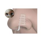 Medlight Horlama1 Önleyici Burun Aparatı