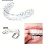 Mepura 515 Bruksizm Gece Aparatı Plağı