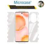 Microcase Huawei Nova 9 Ön Arka Yan 360 Derece Tam Koruma Full Body Hydrogel Film - Fl360