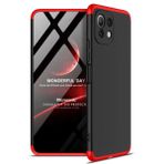 Microsonic Xiaomi Mi 11 Lite Double Dip 360 Protective Siyah Kırmızı Kılıf