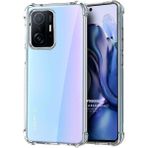 Microsonic Xiaomi Mi 11T Pro Shock Absorbing Şeffaf Kılıf