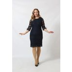Moda Berray Kolları Tüy Detaylı Dantel Elbise Büyük Beden Kısa Abiye