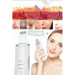 Munico Ultrasonik Yüz Temizleyici - Akne Giderme Cihazı, Peeling Spatula Beyaz Derinlemesine Temizlik İçin