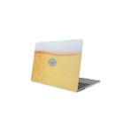 Nacario Mcstorey Macbook Kılıf Air 13 Inç Uyumlu Sert Hardcase Tpu Koruyucu Ince Hafif Laptop Kapak Fizzy D