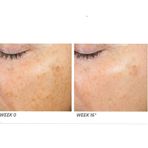 Neostrata Enlighten Illuminating 30 ML Leke Giderici Serum