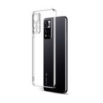 Newface Xiaomi Redmi Note 11 Pro Plus 5G Lüx Şeffaf Silikon Cep Telefonu Kılıfı