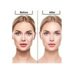 NİRA VERO 48lı yüz germe bandı ,alın,yanak,göz altı,boyun,ince kırışıklık kaldırma,düğün ve özel günler önce