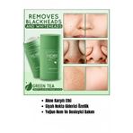 NOIRE PREMIUM Yeşil Çay Özlü Siyah Nokta ve Akne Maskesi & Green Tea Extract Acne and Pimple Mask