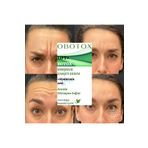 OBOTOX Botoks Etkili Krem, Yaşlanma Ve Kırışıklık Karşıtı Krem, Botoks Yüz Kremi, Anti Aging, 40ml
