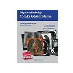 Palme Yayınevi Olgularla Radyoloji Toraks Görüntüleme