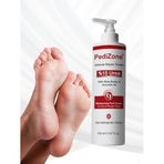 PediZone Yoğun Onarıcı Ayak Kremi,%15 Üre, Çay Agacı shea ağı ve Avokado Yağı İçeren, 150 ml