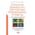Pictorial Essays on Peritoneal Metastases Imaging: CT, MRI and PET-CT