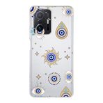 PrintiFy Xiaomi Mi 11T Pro ile Uyumlu 1mm Slim Fit Nazar Boncuğu 5 Baskılı Şeffaf Kılıf