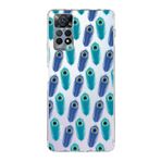 PrintiFy Xiaomi Redmi Note 11 Pro 5G ile Uyumlu 1mm Slim Fit Nazar Boncuğu 4 Baskılı Şeffaf Kılıf