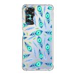 PrintiFy Xiaomi Redmi Note 11 Pro Uyumlu Nazar Boncuğu 3 Baskılı Şeffaf Köşe Korumalı Antişok Kılıf