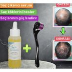 Purexpose Saç bakım Losyonu Sarı - Dermoroller Armağan