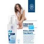 Ras Dashen Topuk Kremi Ayak Bakım Krem Mantar Tırnak Topuk Çatlaklarına Karşı Yumuşatıcı Etkili 100 ml - Beyaz