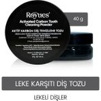 Royues Aktif Karbon Diş Beyazlatma Tozu 40gr - Sararmış Diş Lekesi Giderici, Nefes Tazeleyici