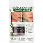 Rozalina Rise Vitamin İçeren Sîvîlce Önleyeci Siyah Nokta Leke,giderici, Yüz Kremi 100 ML