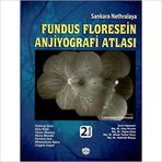 Sankara Nethralaya Fundus Floresein Anjiyografi Atlası - Pukraj Rishi Ekta Rishi Tarun Sharma Muna Bhende Parveen Sen Dhanashree Ratra Lingam Copal