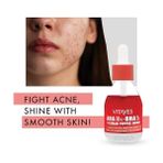 SDT Group Vıtayes Aha%10 Bha%2 Kırmızı Peeling Cilt Serumu - Gözenek Sıkılaştırıcı, Cilt Canlandırıcı, Yenileyici, Ton Eşitleyici, Arındırıcı, Siyah Nokta ve Akne Karşıtı, Anti-Aging, Yaşlanma Karşıtı 30 ml - Option-1