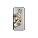 Senada General Mobile Gm 5 Plus İle Uyumlu Kılıf 0.4Mm Lazer Kesim Silikon Kapak Kedi Prisma