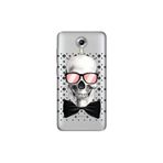 Senada General Mobile Gm 5 Plus İle Uyumlu Kılıf 0.4Mm Lazer Kesim Silikon Kapak Moda Iskelet