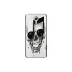 Senada General Mobile Gm 5 Plus İle Uyumlu Kılıf 0.4Mm Lazer Kesim Silikon Kapak Müzisyen Iskelet