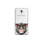 Senada General Mobile Gm 5 Plus İle Uyumlu Kılıf 0.4Mm Lazer Kesim Silikon Kapak Tom