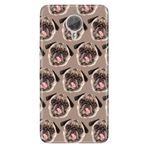 Senada General Mobile Gm 5 Plus İle Uyumlu Kılıf Silikon Desenli Tam Koruma Resimli Pug Pug Köpek