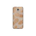 Senada General Mobile Gm 8 İle Uyumlu Kılıf 0.4Mm Lazer Kesim Silikon Kapak Ananas,Color800