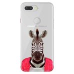 Senada General Mobile Gm 9 Pro İle Uyumlu Kılıf Silikon Desenli Tam Koruma Resimli Şirin Zebra