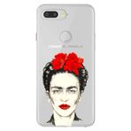 Senada General Mobile Gm 9 Pro İle Uyumlu Kılıf Silikon Desenli Tam Koruma Resimli Xfridax