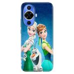 Senada Huawei Nova 12S ile Uyumlu Kılıf Desenli TPU Cover Silikon ElsaAnnaOlaf