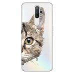 Senada Oppo A5 A9 2020 İle Uyumlu Kılıf Silikon Desenli Tam Koruma Resimli Kapak Kedi Prizma