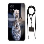 Senada Redmi Note 12S ile Uyumlu Kılıf Big Cat Desenli Silikon İpli Boyun Askı Aparatı