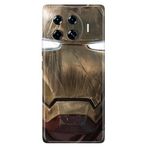 Senada Tecno Spark 20 Pro Plus 6.78İnc İle Uyumlu Kılıf Dekoratif Silikon Baskılı Kapak Iron
