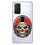 Senada Uyumlu Xiaomi Redmi Note 11 Pro 5G İle Uyumlu Kılıf 0.4Mm Lazer Kesim Silikon Kuru Kafa