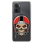 Senada Xiaomi Redmi Note 11E İle Uyumlu Kılıf 0.4Mm Silikon Desenli Kuru Kafa