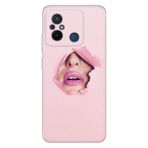 Senada Xiaomi Redmi Note 12 5G İle Uyumlu Kılıf Silikon Desenli Resimli Kapak Saklı Aşk