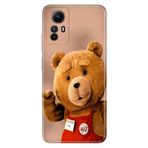 Senada Xiaomi Redmi Note 12s ile Uyumlu Kılıf Resimli Desenli Silikon Teddy
