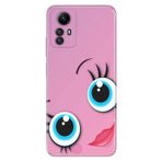 Senada Xiaomi Redmi Note 12S İle Uyumlu Kılıf Silikon Desenli Resimli Kapak Sevgidolu