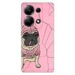 Senada Xiaomi Redmi Note 13 4G İle Uyumlu Kılıf Temalı Silikon Desenli Süslü Tarz Pug