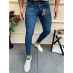 Ser Joven Erkek Mavi Slim Fit Lazerli Likralı Jean Pantolon - 34