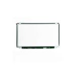 Sılındır Kapak Contası 3008 308 Rcz 207- 508 208 5008 C4 C4 Pıcasso Ds3 Ds5 C5 Iıı Ep6dt Ep6cdt 308